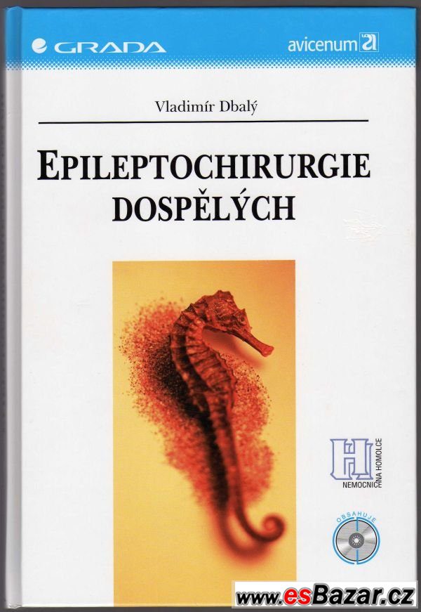 EPILEPTOCHIRURGIE DOSPĚLÝCH