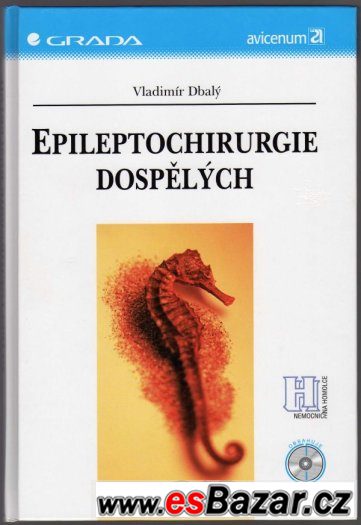 EPILEPTOCHIRURGIE DOSPĚLÝCH