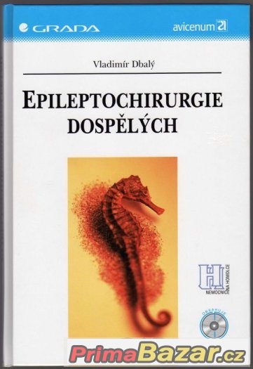 EPILEPTOCHIRURGIE DOSPĚLÝCH