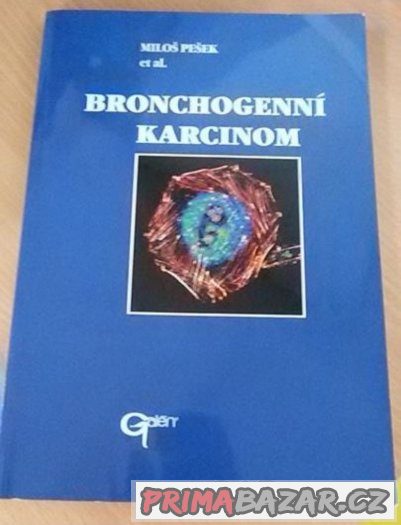 Bronchogenní karcinom Galén