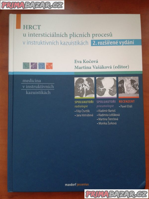 hrct-u-intersticialnich-plicnich-procesu-medicina